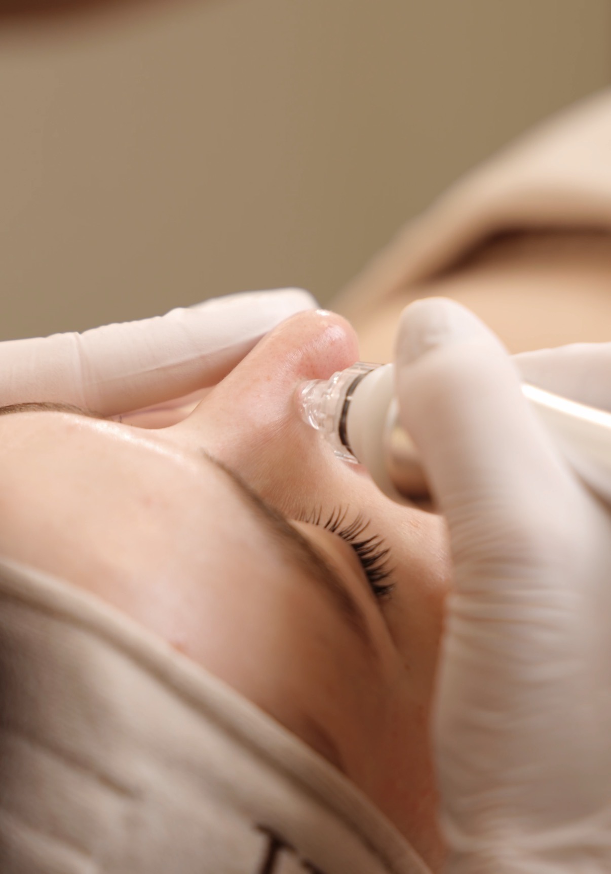 Biopeeling i oczyszczanie wodorowe - etap przygotowania