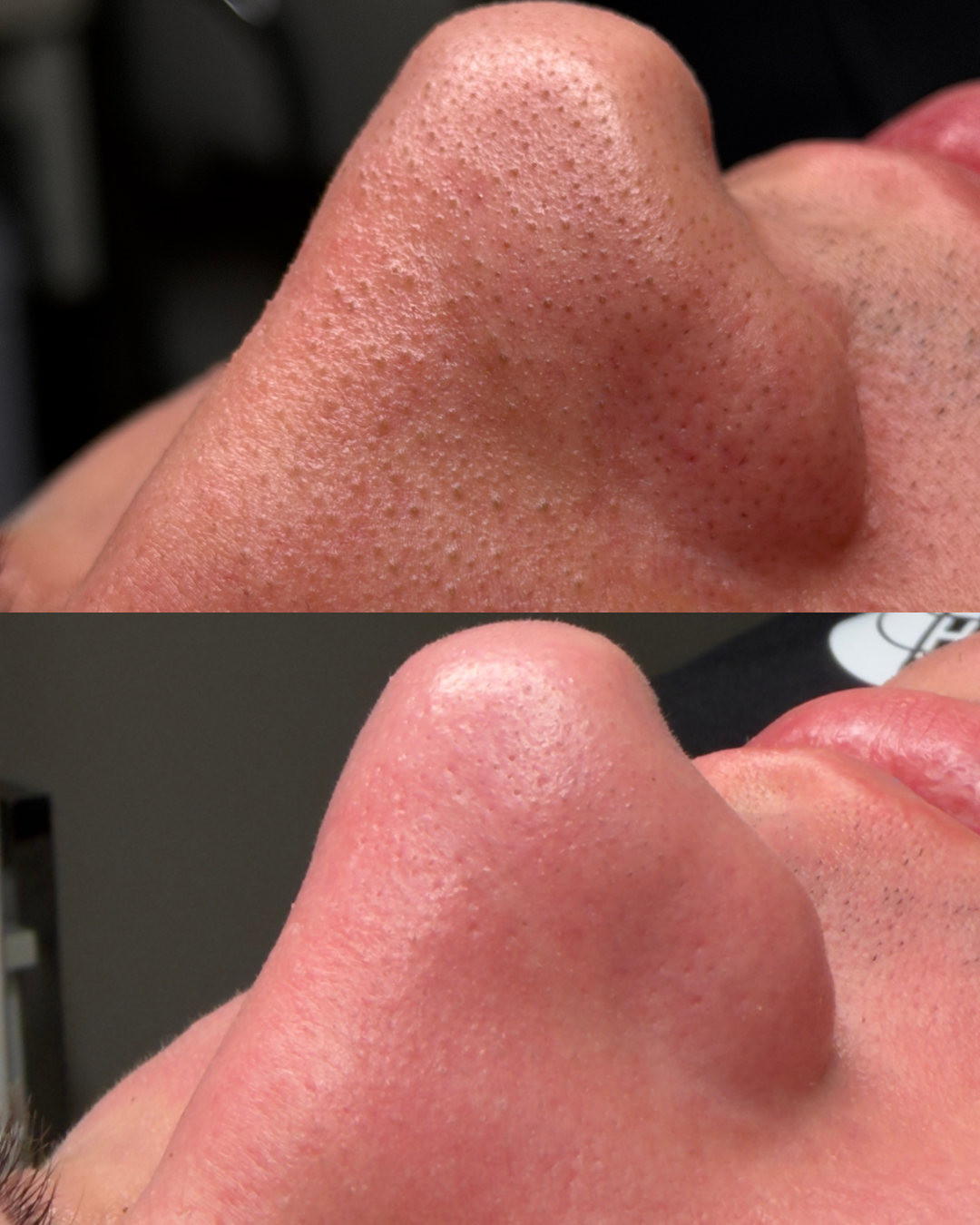 Oczyszczanie gąbką morską - efekt wygładzonej skóry